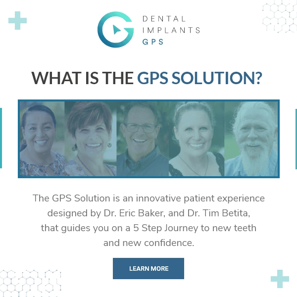 Dental Implants GPS - Gallery Photo